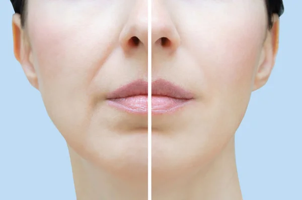 anti-age-протокол Teoxane